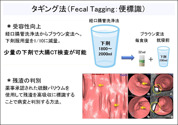 タギング法（Fecal Tagging:便標識）