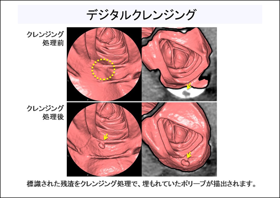 デジタルクレンジング